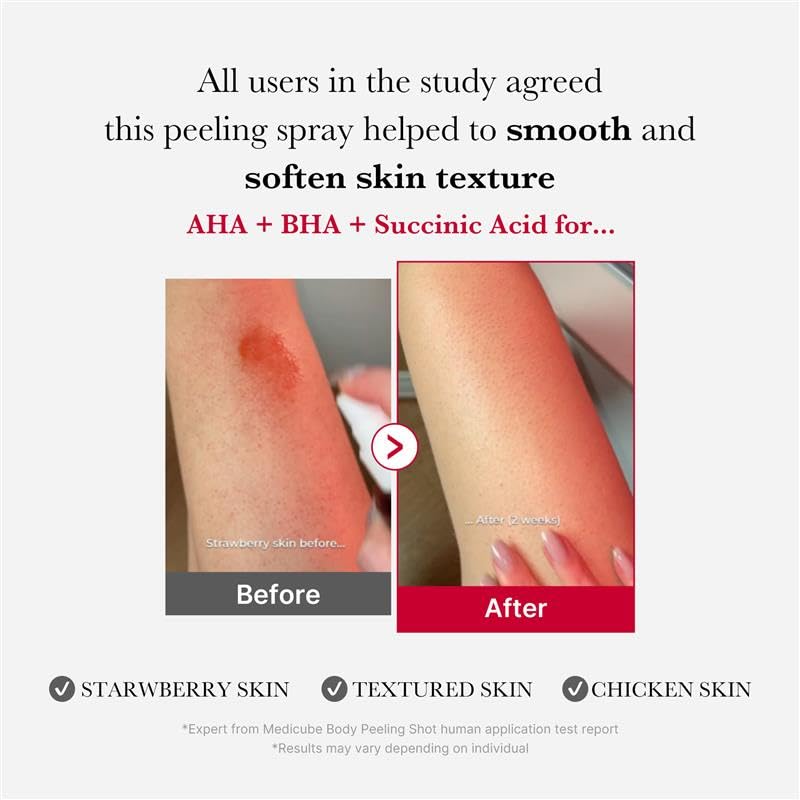 Medicube Red Acne Body Peeling Shot (110 g / 3.88 oz)