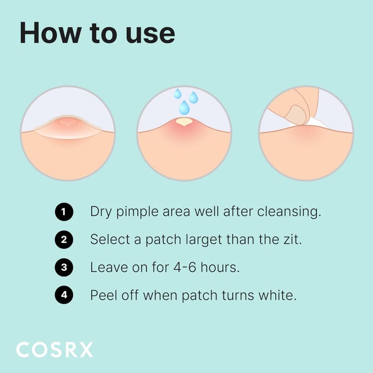 COSRX Acne Pimple Master Patch (24 Patches)